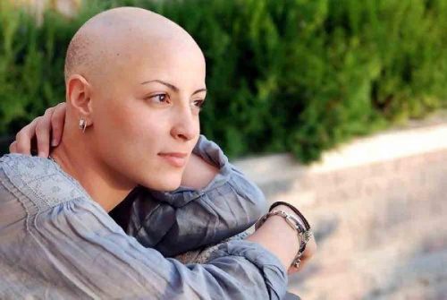 A woman with no hair
